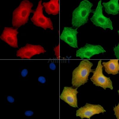 EDEM2 Antibody - DF9503 staining A549 cells by IF/ICC.