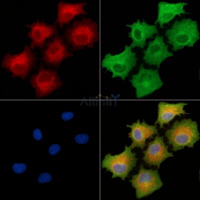 GABRR1 Antibody - DF9525 staining A549 cells by IF/ICC.