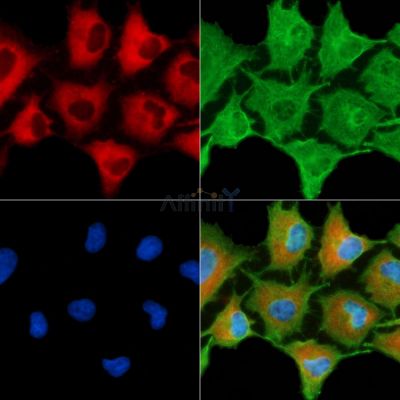 HLA-DQB2 Antibody - DF9574 staining A549 cells by IF/ICC.