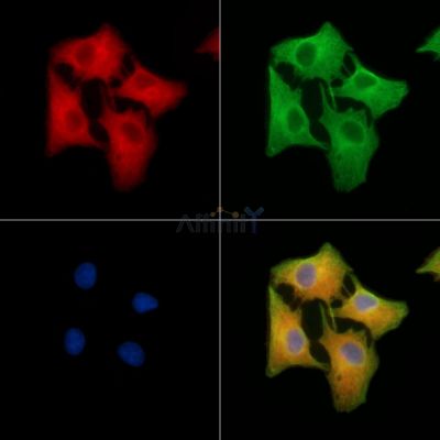 VPREB1 Antibody - DF9594 staining A549 cells by IF/ICC.