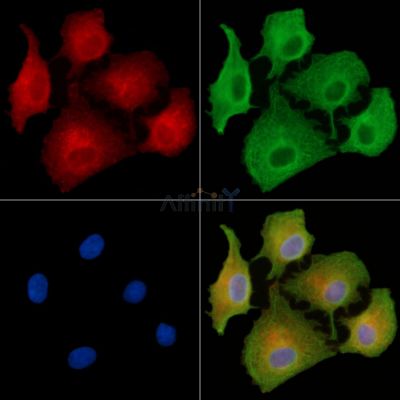 MYBPC2 Antibody - DF9649 staining A549 cells by IF/ICC.