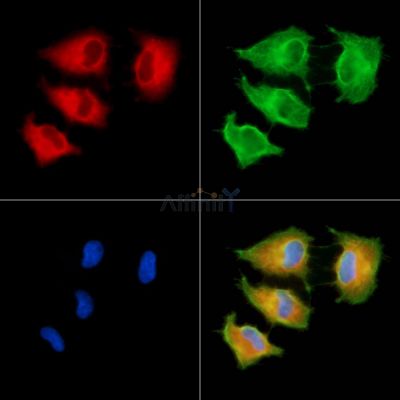 MYO3B Antibody - DF9652 staining A549 cells by IF/ICC.