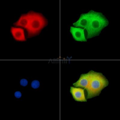 MYO3B Antibody - DF9652 staining Hela cells by IF/ICC.