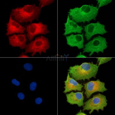 NDUFB5 Antibody - DF9664 staining A549 cells by IF/ICC.