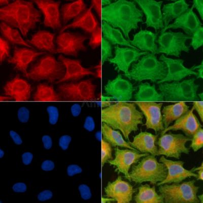 NDUFB7 Antibody - DF9665 staining A549 cells by IF/ICC.