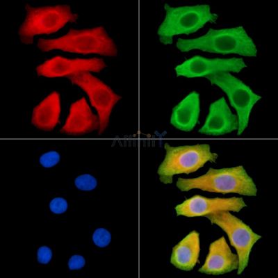 MT-ND2 Antibody - DF9674 staining Hela cells by IF/ICC.