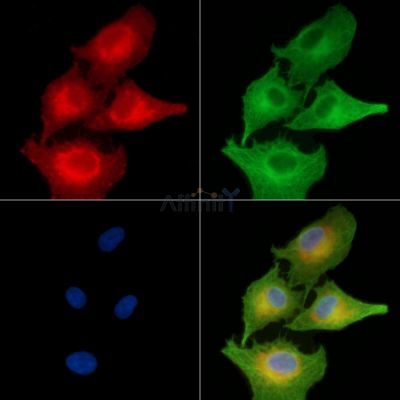 NPHP1 Antibody - DF9678 staining A549 cells by IF/ICC.
