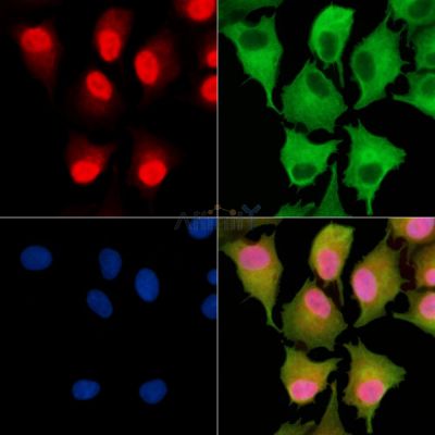 TNP2 Antibody - DF9713 staining A549 cells by IF/ICC.