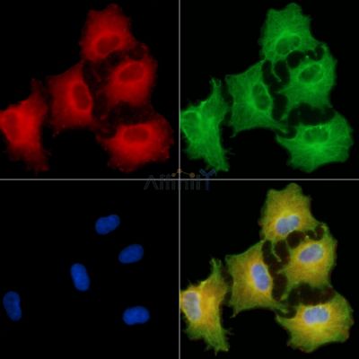 TIGA1 Antibody - DF9793 staining A549 cells by IF/ICC.