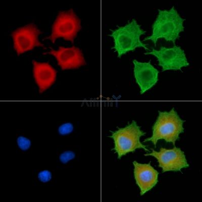 RABL2B Antibody - DF9797 staining A549 cells by IF/ICC.