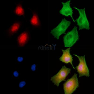 RGS22 Antibody - DF9848 staining A549 cells by IF/ICC.