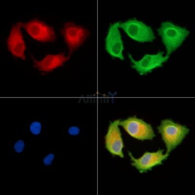 RFPL4B Antibody - DF9851 staining A549 cells by IF/ICC.