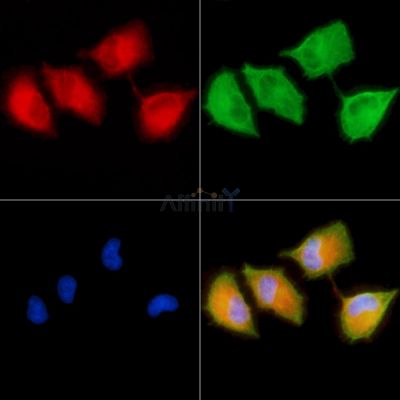 RHG6 Antibody - DF9863 staining A549 cells by IF/ICC.