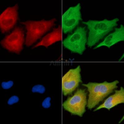 RPS6KL1 Antibody - DF9871 staining A549 cells by IF/ICC.