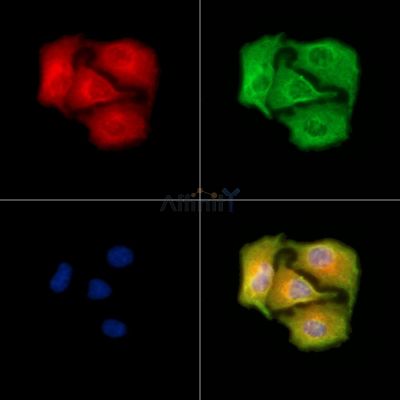 SCARA3 Antibody - DF9878 staining A549 cells by IF/ICC.