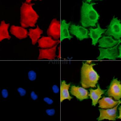 SH3PXD2A Antibody - DF9902 staining A549 cells by IF/ICC.