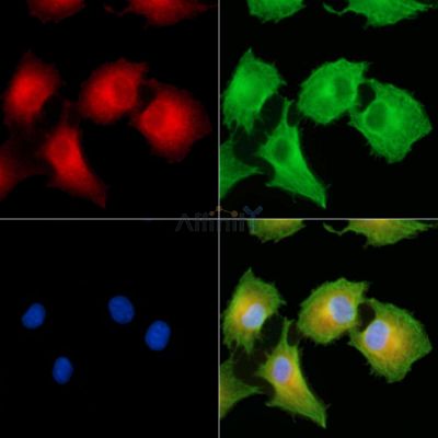 SLC6A12 Antibody - DF9921 staining A549 cells by IF/ICC.
