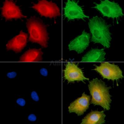 SLC6A18 Antibody - DF9925 staining A549 cells by IF/ICC.