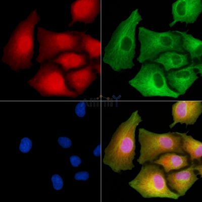 BTF3L2 Antibody - DF9972 staining A549 cells by IF/ICC.