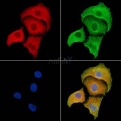 BTF3L3 Antibody - DF9973 staining A549 cells by IF/ICC.