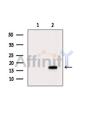 UBE2A/B Antibody - Western blot analysis of extracts from RAW264.