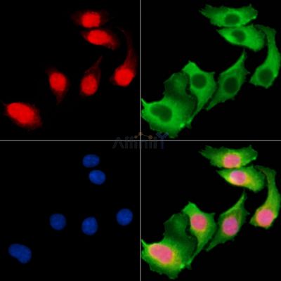 CTR9 Antibody - DF13764 staining Hela cells by IF/ICC.