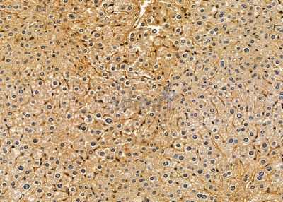 ANKH Antibody - DF13836 at 1/100 staining mouse liver tissue by IHC-P.
