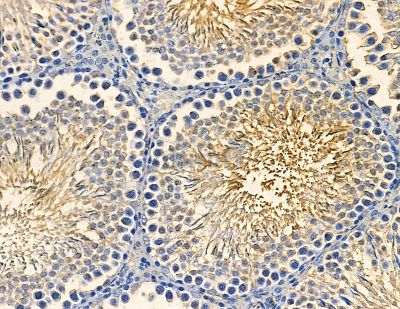 RICH2 Antibody - DF13841 at 1/100 staining rat testis tissue by IHC-P.