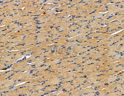 GDF 5 Antibody - DF13842 at 1/100 staining rat muscle tissue by IHC-P.