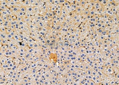 RRBP1 Antibody - DF13844 at 1/100 staining mouse liver tissue by IHC-P.
