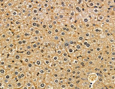 ZNF313 Antibody - DF13849 at 1/100 staining mouse liver tissue by IHC-P.