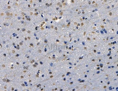 ZNF313 Antibody - DF13849 at 1/100 staining mouse brain tissue by IHC-P.