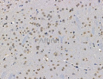 ZNF313 Antibody - DF13849 at 1/100 staining rat brain tissue by IHC-P.