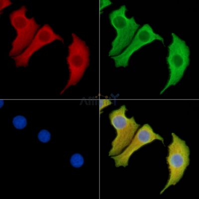 GDAP1 Antibody - DF13855 staining Hela cells by IF/ICC.