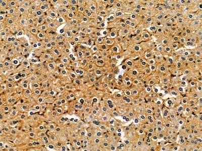 GDAP1 Antibody - DF13855 at 1/100 staining mouse skin tissue by IHC-P.
