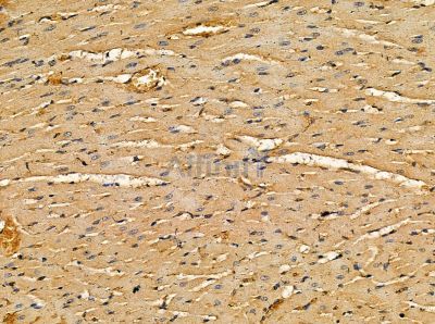 TTLL10 Antibody - DF13857 at 1/100 staining rat heart tissue by IHC-P.