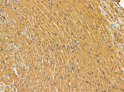 NAA60 Antibody - DF13864 at 1/100 staining mouse heart tissue by IHC-P.