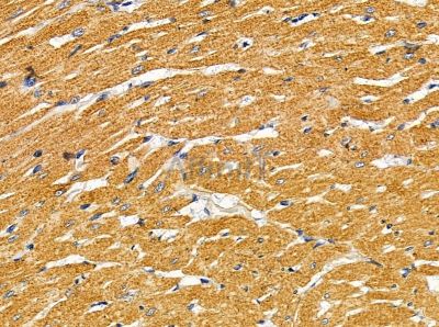 NAA60 Antibody - DF13864 at 1/100 staining rat heart tissue by IHC-P.