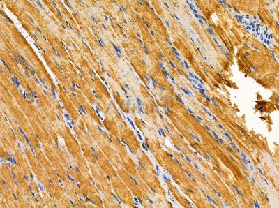 NAA60 Antibody - DF13864 at 1/100 staining rat muscle tissue by IHC-P.