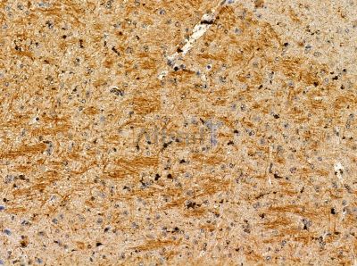 APC2 Antibody - DF13875 at 1/100 staining mouse brain tissue by IHC-P.