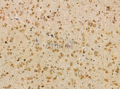 APC2 Antibody - DF13875 at 1/100 staining rat brain tissue by IHC-P.