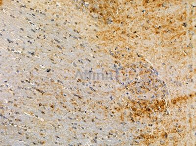 Protease Inhibitor 15 Antibody - DF13876 at 1/100 staining rat brain tissue by IHC-P.
