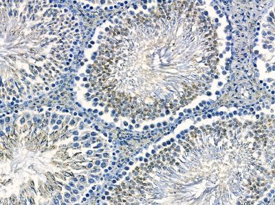 calcyphosine Antibody - DF13955 at 1/100 staining rat testis tissue by IHC-P.