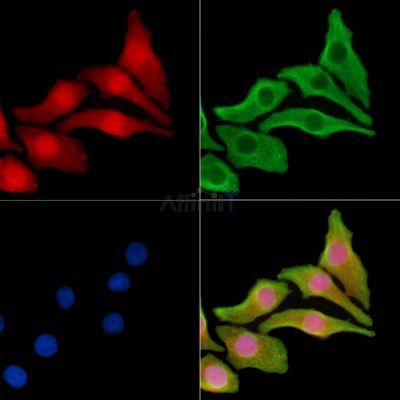TRIM17 Antibody - DF13958 staining Hela cells by IF/ICC.