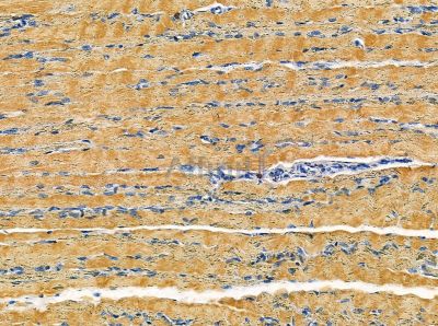 Pellino 1 Antibody - DF13966 at 1/100 staining rat muscle tissue by IHC-P.