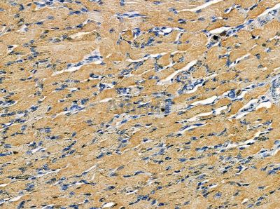 LIME Antibody - DF13967 at 1/100 staining rat muscle tissue by IHC-P.