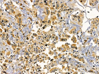 TLR10 Antibody - DF13970 at 1/100 staining rat colorectal tissue by IHC-P.