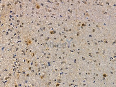 MED13 Antibody - DF14073 at 1/100 staining rat brain tissue by IHC-P.