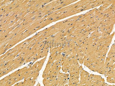 MTSS1 Antibody - DF14076 at 1/100 staining rat heart tissue by IHC-P.