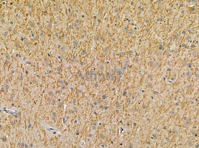 MTSS1 Antibody - DF14076 at 1/100 staining rat brain tissue by IHC-P.